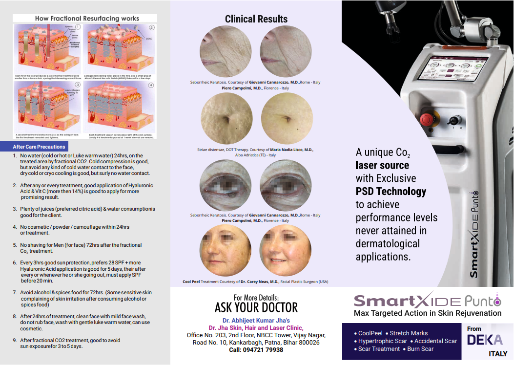 Diode Laser Treatment